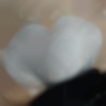 Лікування врослого