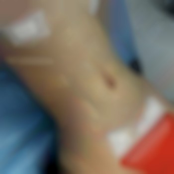 Абдель Эрритали, Киев Фото - 22