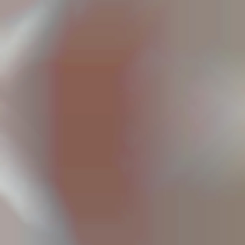 После процедуры бикини, фото - мастер депиляции Вікторія Грінченко