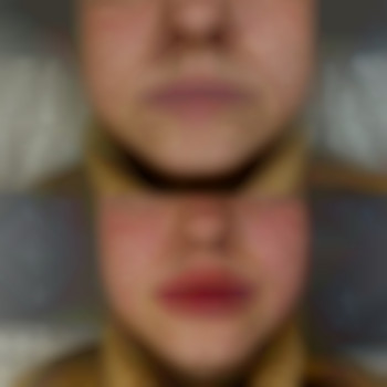 Фото из портфолио специалиста Диана Скоркина (стоматолог, Харьков)