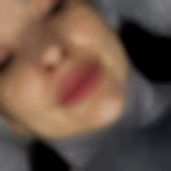 Фото из портфолио специалиста Диана Скоркина (стоматолог, Харьков)