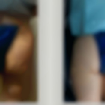 Коррекция фигуры пластическая операция тела, фото - косметологический центр Safe Cosmo Kyiv