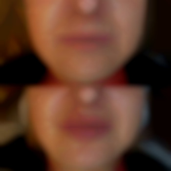 Фото из портфолио специалиста Диана Скоркина (стоматолог, Харьков)