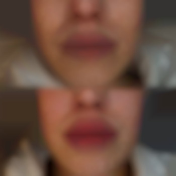 Фото из портфолио специалиста Диана Скоркина (стоматолог, Харьков)