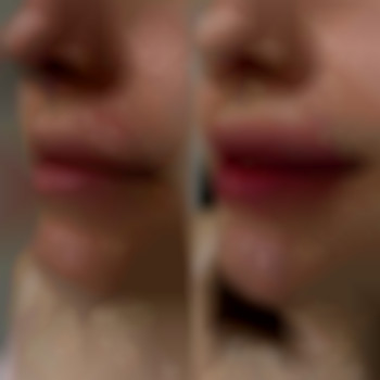 Фото из портфолио специалиста Диана Скоркина (стоматолог, Харьков)