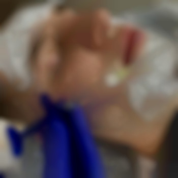 Фото из портфолио специалиста Диана Скоркина (стоматолог, Харьков)