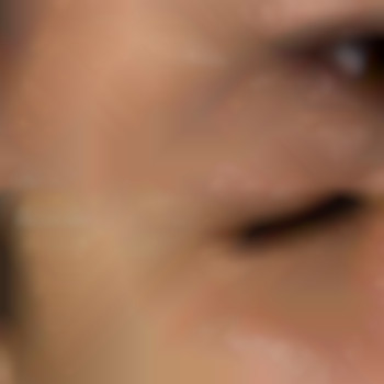 Фото из портфолио специалиста Диана Скоркина (стоматолог, Харьков)