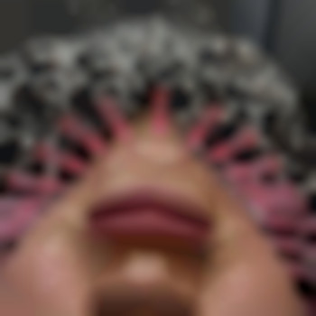 Фото из портфолио специалиста Диана Скоркина (стоматолог, Харьков)