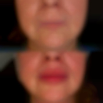 Фото из портфолио специалиста Диана Скоркина (стоматолог, Харьков)