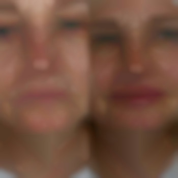 Фото из портфолио специалиста Диана Скоркина (стоматолог, Харьков)