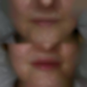 Фото из портфолио специалиста Диана Скоркина (стоматолог, Харьков)