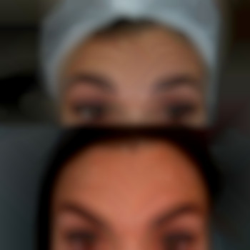 Фото из портфолио специалиста Диана Скоркина (стоматолог, Харьков)