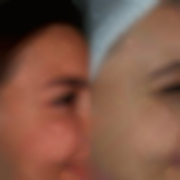 Фото из портфолио специалиста Диана Скоркина (стоматолог, Харьков)