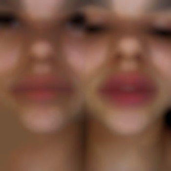 Фото из портфолио специалиста Диана Скоркина (стоматолог, Харьков)