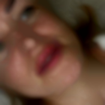 Первичные губки🌺
Препарат: Stylage M 1ml, фото - стоматолог Диана Скоркина