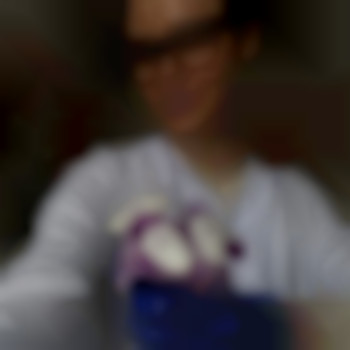 Выбираю для вас только самое лучшее 💜
Мой ТОП филлер для контурной пластики-💥 STYLAGE💥, фото - стоматолог Диана Скоркина