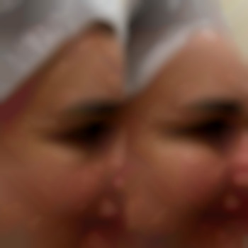 Фото из портфолио специалиста Диана Скоркина (стоматолог, Харьков)