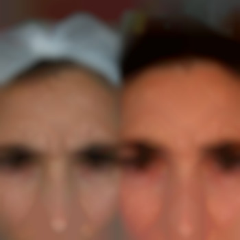 Фото из портфолио специалиста Диана Скоркина (стоматолог, Харьков)