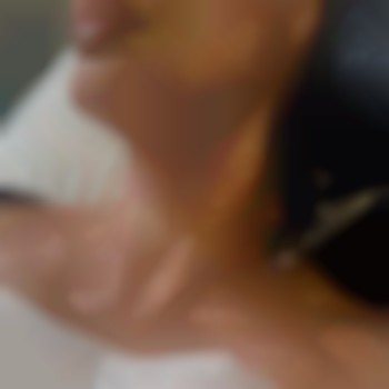 БІОРЕВІТАЛІЗАЦІЯ препаратом в складі колаген та поліонуклеотиди