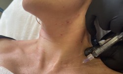 Лебедина шия Косметолог Ирина Одесса