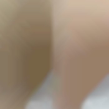 Видалення зайвого волосся в області бікіні.

 #депіляція #епіляція #бікіні