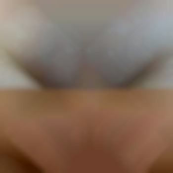 Lumenis Desire Лазерна епіляція ноги повністю (жіночі)
                    Косметологический центр Ендосфера центр Кременчуг