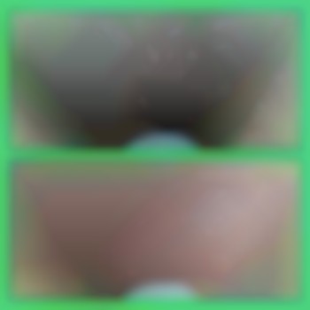 Депіляція воском зони глибокого бікіні