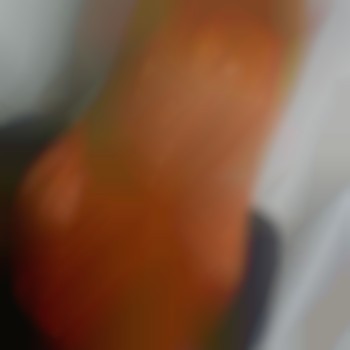 Після Ботоксу