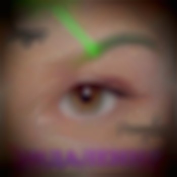 Видалення міні татуювань та перманентного макіяжу за допомогою лазеру та ремуверу.