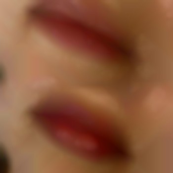 Первинна процедура корекції губ.
природній ефект за бажанням пацієнтки