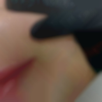 Мезотерапия, фото - косметолог Виктория Носа