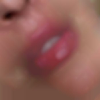 Збільшення губ