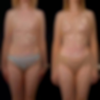 Денис Юрченко , Буковель Фото - 1