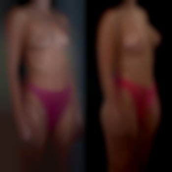 Денис Юрченко , Буковель Фото - 2