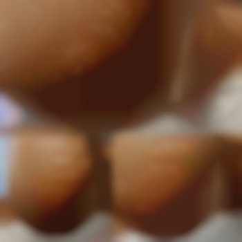 Апаратний педикюр