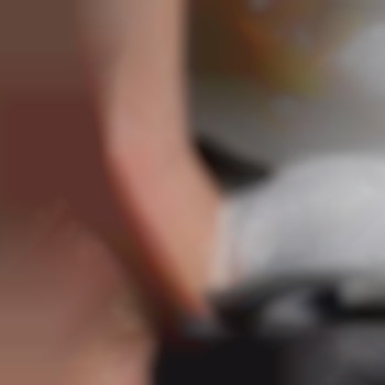 Корекція платизми