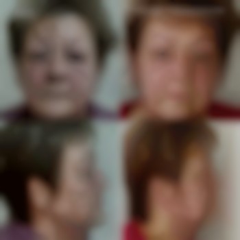  #Векторный_массаж_лица
 #Векторний_масаж_обличчя
 #скульптурний #лiмфодренажний #вiд_зморшок #мiофасциальний #пластичний