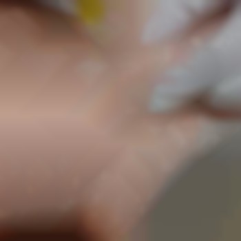  #уколикраси
 #мезотерапія