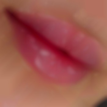 1мл філлера