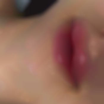 1мл філлера