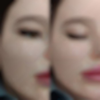 Фото до та після процедури