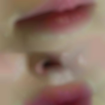 увеличение губ, контурная пластика губ, аугментация губ