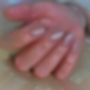 Корекція + укріплення