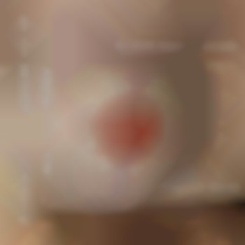 Камуфляж ареол
                    Мастер перманентного макияжа Наталя Тернополь