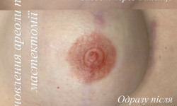 Камуфляж ареол Мастер перманентного макияжа Наталя Тернополь