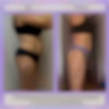 Корекція фігури / Моделювання тіла