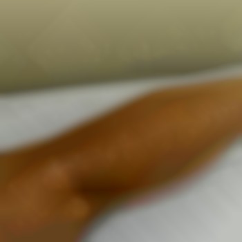 Працює на засмаглій шкірі