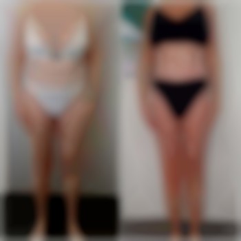 Результат після проходження курсу 10 процеду