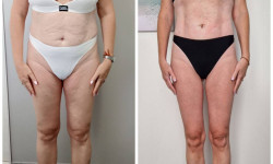 Вибромасаж Массажный салон Студия аппаратних массажей Studio 18 Днепр