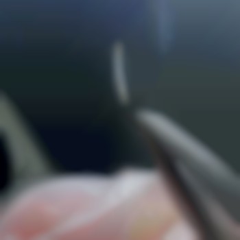 На фото фолікул у фазі анаген( активна фазі) якщо таке волосся майстер видаляє , то на його місці вже немає живлення